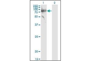 Western Blotting (WB) image for anti-Serpin Peptidase Inhibitor, Clade G (C1 Inhibitor), Member 1 (SERPING1) (AA 1-501) antibody (ABIN782340)