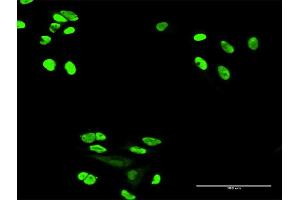 Immunofluorescence of purified MaxPab antibody to XRCC6 on HeLa cell. (XRCC6 抗体  (AA 1-609))