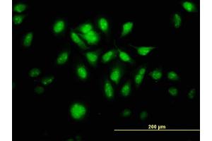 Immunofluorescence of monoclonal antibody to MTA1 on HeLa cell. (MTA1 抗体  (AA 601-700))
