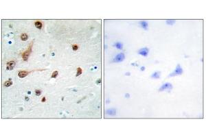 Immunohistochemistry analysis of paraffin-embedded human brain tissue, using ADAR1 antibody. (ADAR 抗体  (C-Term))