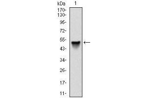 Western blot analysis using SRC mAb against human SRC (AA: 1-189) recombinant protein.
