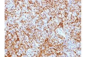 Formalin-fixed, paraffin-embedded human Spleen stained with CD61 Rabbit Recombinant Monoclonal Antibody (ITGB3/2166R). (Recombinant Integrin beta 3 抗体  (AA 385-490))