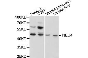 Western blot analysis of extracts of various cell lines, using NEU4 antibody (ABIN1876358) at 1:1000 dilution. (Sialidase 4 抗体)
