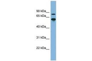 Image no. 1 for anti-ATP-Binding Cassette, Sub-Family F (GCN20), Member 2 (ABCF2) (AA 143-192) antibody (ABIN6741721) (ABCF2 抗体  (AA 143-192))