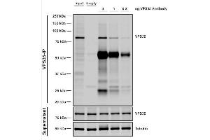 Immunoprecipitation (IP) image for anti-Vacuolar Protein Sorting 35 (VPS35) antibody (Biotin) (ABIN6933016)