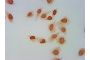 Immunocytochemistry analysis of ABIN7139600 diluted at 1:5 and staining in Hela cells performed on a Leica BondTM system. (H2AFZ 抗体  (meLys4))
