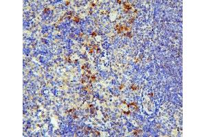 IHC analysis of IL31 using anti-IL31 antibody (ABIN6719334).