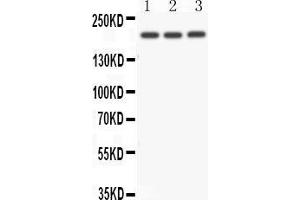 Anti- NOTCH4 antibody, Western blotting All lanes: Anti NOTCH4  at 0. (NOTCH4 抗体  (C-Term))