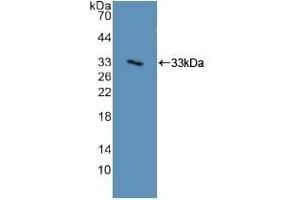 Detection of Recombinant ITGa2, Human using Polyclonal Antibody to Integrin Alpha 2 (ITGa2) (ITGA2 抗体  (AA 74-277))