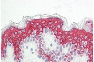 anti-Vacuolar Protein Sorting 13 Homolog B (Yeast) (VPS13B) (N-Term) antibody