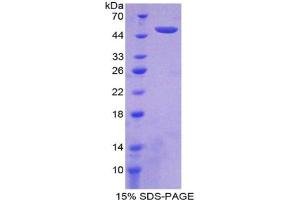 SDS-PAGE analysis of Human Interferon alpha 21 Protein. (IFNA21 蛋白)