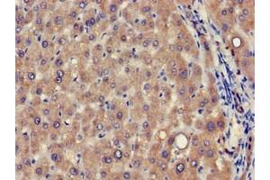 Immunohistochemistry of paraffin-embedded human liver tissue using ABIN7175353 at dilution of 1:100 (VPS39 抗体  (AA 263-490))