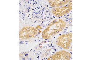 (ABIN1944892 and ABIN2838534) staining H in human kidney tissue sections by Immunohistochemistry (IHC-P - raformaldehyde-fixed, raffin-embedded sections). (Phenylalanine Hydroxylase 抗体  (AA 127-161))