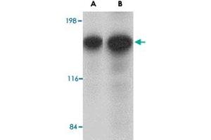Western blot analysis of CADPS in rat brain tissue lysate with CADPS polyclonal antibody  at (A) 0. (CADPS 抗体  (N-Term))