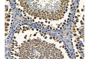 ABIN6264551 and ABIN6272407 at 1/100 staining rat testis tissue by IHC-P. (RAB11FIP4 抗体  (Internal Region))