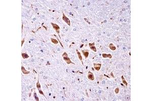 Immunohistochemistry (IHC) image for anti-PAK3 (PAK3) (AA 124-152) antibody (ABIN3028914)