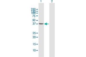 Western Blot analysis of NSDHL expression in transfected 293T cell line by NSDHL MaxPab polyclonal antibody. (NSDHL 抗体  (AA 1-373))