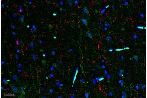Image no. 3 for anti-Interleukin 11 (IL11) antibody (ABIN465144) (IL-11 抗体)
