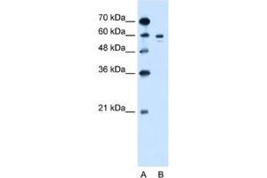 Western Blotting (WB) image for anti-Tyrosinase (TYR) antibody (ABIN2462800) (TYR 抗体)