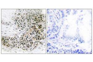 Immunohistochemistry (IHC) image for anti-Trichorhinophalangeal Syndrome I (TRPS1) (N-Term) antibody (ABIN1850056) (TRPS1 抗体  (N-Term))