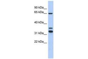 Image no. 1 for anti-S100P Binding Protein (S100PBP) (C-Term) antibody (ABIN6744009) (S100PBP 抗体  (C-Term))