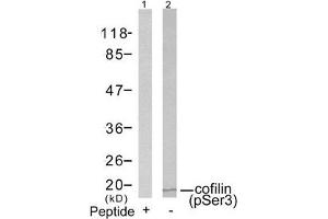 Western blot analysis of extracts from COLO205 cells using cofilin(Phospho-Ser3) Antibody(Lane 2) and the same antibody preincubated with blocking peptide(Lane1). (Cofilin 抗体  (pSer3))