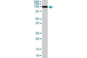 ADAM17 polyclonal antibody  staining (0. (ADAM17 抗体)