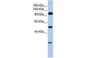 WB Suggested Anti-KL Antibody Titration: 0. (Klotho 抗体  (Middle Region))