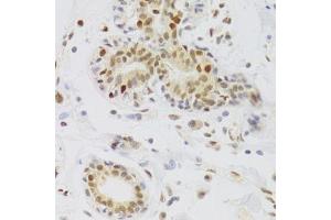 Immunohistochemistry (Paraffin-embedded Sections) (IHC (p)) image for anti-Nuclear Autoantigenic Sperm Protein (Histone-Binding) (NASP) (AA 180-449) antibody (ABIN6144374)