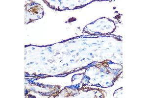 Immunohistochemistry of paraffin-embedded human placenta using CD55 Rabbit mAb (ABIN7266478) at dilution of 1:100 (40x lens). (CD55 抗体)