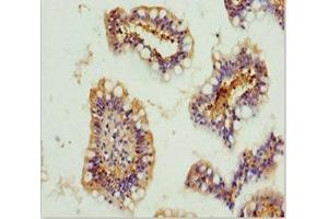 Immunohistochemistry of paraffin-embedded human small intestine tissue using ABIN7154739 at dilution of 1:100 (GNA15 抗体  (AA 1-374))