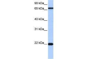 Human Jurkat; WB Suggested Anti-ACCSL Antibody Titration: 0. (ACCSL 抗体  (N-Term))