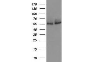 Western Blotting (WB) image for anti-Catalase (CAT) antibody (ABIN1497109) (Catalase 抗体)
