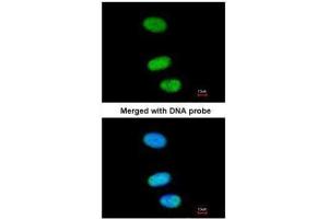 ICC/IF Image Immunofluorescence analysis of paraformaldehyde-fixed HeLa, using SOX13, antibody at 1:200 dilution. (SOX13 抗体)