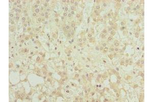 Immunohistochemistry of paraffin-embedded human adrenal gland tissue using ABIN7158923 at dilution of 1:100 (MFSD8 抗体  (AA 1-40))