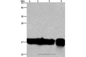 Western blot analysis of A549 and K562 cell, Raji cell and human fetal intestine tissue, using IL17C Polyclonal Antibody at dilution of 1:300 (IL17C 抗体)