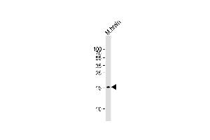 Mouse brain lysate (20µg) probed with bsm-51134M GABARAP (424CT5. (GABARAP 抗体)