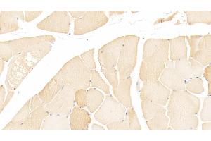 Immunohistochemistry (IHC) image for anti-Myosin, Light Chain 3 (MYL3) (AA 5-181) antibody (ABIN7439033)