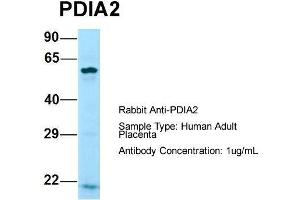 Host: Rabbit  Target Name: PDIA2  Sample Tissue: Human Adult Placenta  Antibody Dilution: 1. (PDIA2 抗体  (N-Term))