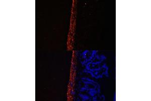 Immunofluorescence analysis of Mouse intestine using MYL9 antibody (ABIN3023462, ABIN3023463, ABIN3023464 and ABIN6220005) at dilution of 1:100.