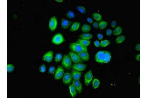 Immunofluorescent analysis of A549 cells using ABIN7153440 at dilution of 1:100 and Alexa Fluor 488-congugated AffiniPure Goat Anti-Rabbit IgG(H+L) (LGALS1/Galectin 1 抗体  (AA 2-135))