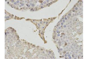 Immunohistochemistry (IHC) image for anti-Proteasome (Prosome, Macropain) Subunit, beta Type, 1 (PSMB1) antibody (ABIN1875399) (PSMB1 抗体)