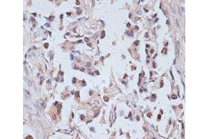 Immunohistochemistry (Paraffin-embedded Sections) (IHC (p)) image for anti-Tax1 (Human T-Cell Leukemia Virus Type I) Binding Protein 1 (TAX1BP1) antibody (ABIN7259536)