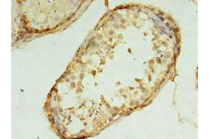 Immunohistochemistry of paraffin-embedded human testis tissue using ABIN7173289 at dilution of 1:100 (TMEM9 抗体  (AA 111-183))