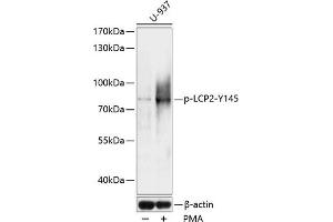 Western blot analysis of extracts of U937 cells, using Phospho-LCP2-Y145 antibody (ABIN7268318) at 1:1000 dilution. (LCP2 抗体  (pTyr145))