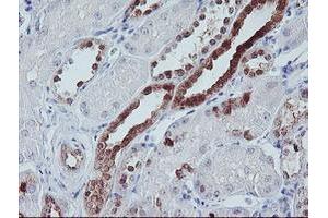 Image no. 2 for anti-Interferon Regulatory Factor 6 (IRF6) antibody (ABIN1498901) (IRF6 抗体)