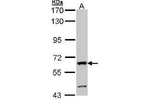 WB Image Sample (30 ug of whole cell lysate) A: Hep G2 , 7. (Intestinal Alkaline Phosphatase 抗体)