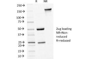 SDS-PAGE Analysis Purified E-Cadherin Mouse Monoclonal Antibody (CDH1/1525).