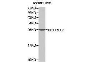 Western Blotting (WB) image for anti-Neurogenin 1 (NEUROG1) antibody (ABIN1873884) (Neurogenin 1 抗体)