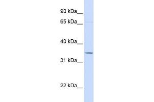 WB Suggested Anti-TOLLIP Antibody Titration: 0. (TOLLIP 抗体  (C-Term))